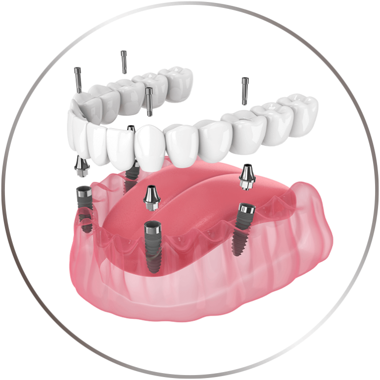 Eastman Craighead Periodontics Dentist Bradenton, FL
