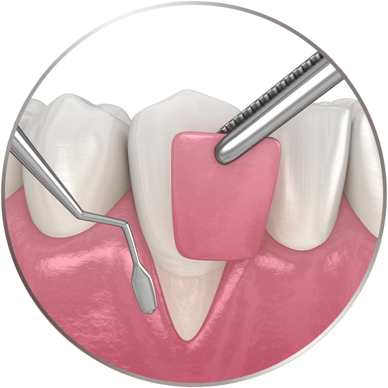 Eastman Craighead Periodontics Dentist Bradenton, FL