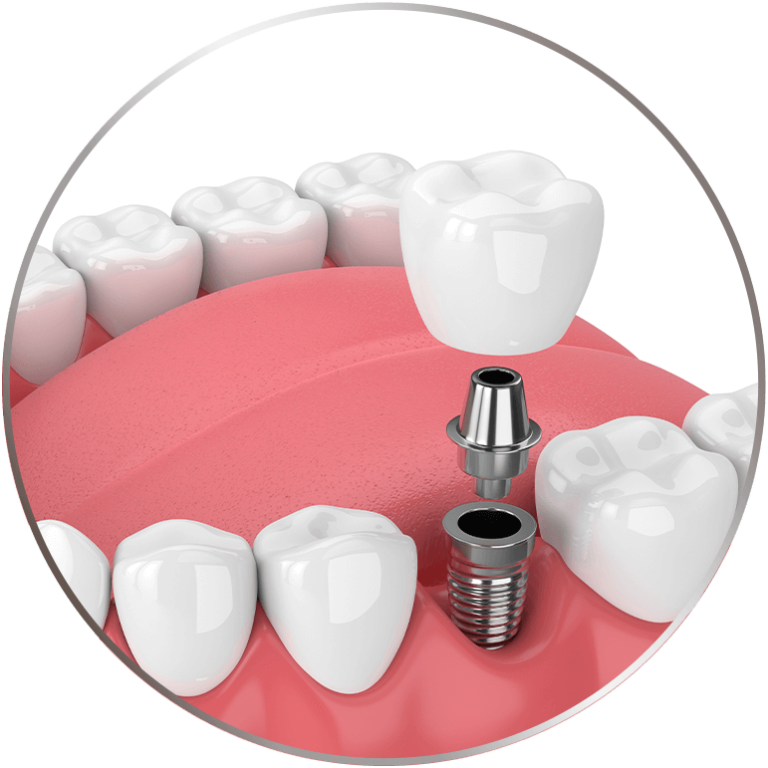 Eastman Craighead Periodontics Dentist Bradenton, FL