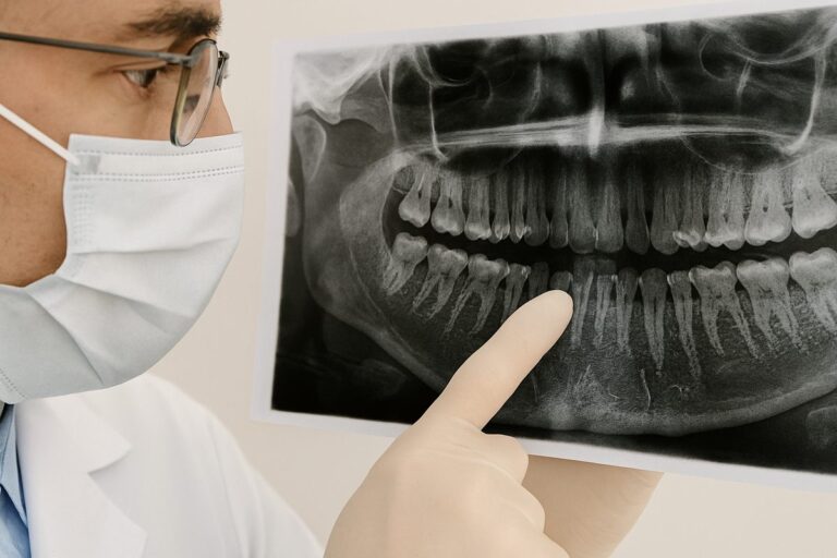 Close-up of a dentist pointing to an x-ray of a patient's mouth, highlighting areas of gum disease and bone loss. No text on image.